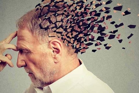 Alzheimer