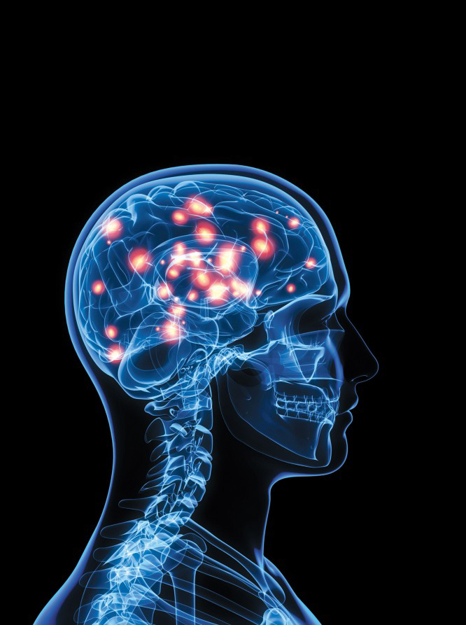 epilepsy